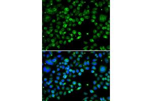 Immunofluorescence (IF) image for anti-Thioredoxin Domain Containing 5 (Endoplasmic Reticulum) (TXNDC5) (AA 1-324) antibody (ABIN6149727)