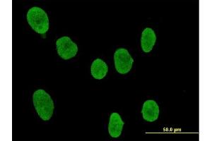 Immunofluorescence of purified MaxPab antibody to SOCS4 on HeLa cell.