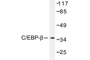 Image no. 1 for anti-CCAAT/enhancer Binding Protein (C/EBP), beta (CEBPB) antibody (ABIN265332) (CEBPB Antikörper)