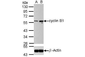 WB Image Western blot analysis of cyclin B1 (, upper panel) and beta-actin , lower panel) Sample (30 ug of whole cell lysate) A: U2OS B: U2OS treated 100ng/ml Nocodazole 16hr 10% SDS PAGE antibody diluted at 1:500 (Cyclin B1 Antikörper)