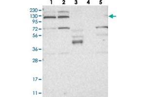 Western blot analysis of Lane 1: RT-4, Lane 2: U-251 MG, Lane 3: Human Plasma, Lane 4: Liver, Lane 5: Tonsil with KIF4A polyclonal antibody  at 1:250-1:500 dilution. (KIF4A Antikörper)