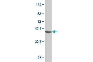 Western Blot detection against Immunogen (37. (SOX30 Antikörper  (AA 644-753))