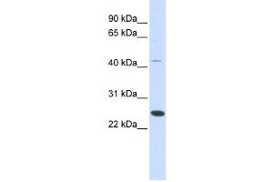 Western Blotting (WB) image for anti-Family With Sequence Similarity 119A (FAM119A) antibody (ABIN2459591) (FAM119A Antikörper)