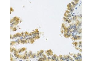 Immunohistochemistry of paraffin-embedded Mouse lung using NMU Polyclonal Antibody at dilution of 1:100 (40x lens). (Neuromedin U Antikörper)