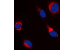 Immunofluorescent analysis of Beta-tubulin staining in Jurkat cells. (TUBB Antikörper  (C-Term))