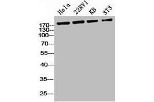 Western Blot analysis of HELA 22RV1 KB NIH-3T3 cells using Phospho-IRS-1 (S636) Polyclonal Antibody (IRS1 Antikörper  (pSer636))