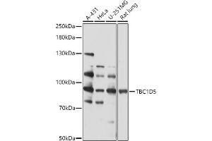 Western blot analysis of extracts of various cell lines, using TBC1D5 antibody (ABIN7270750) at 1:1000 dilution. (TBC1D5 Antikörper  (AA 446-795))