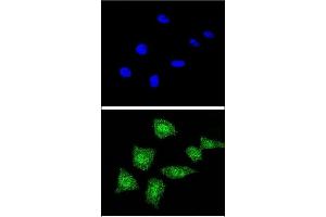 Confocal immunofluorescent analysis of SOD1 Antibody (Center) (ABIN652681 and ABIN2842453) with 293 cell followed by Alexa Fluor® 488-conjugated goat anti-rabbit lgG (green). (SOD1 Antikörper  (AA 55-84))