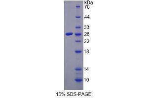 SDS-PAGE analysis of Human CETP Protein.