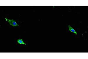 Immunofluorescent analysis of Hela cells using ABIN7177325 at dilution of 1:100 and Alexa Fluor 488-congugated AffiniPure Goat Anti-Rabbit IgG(H+L) (ITGB1 Antikörper  (AA 21-728))