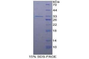 SDS-PAGE analysis of Human Smad5 Protein. (SMAD5 Protein)