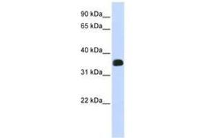 Image no. 1 for anti-Chromosome 2 Open Reading Frame 47 (C2orf47) (C-Term) antibody (ABIN6740965) (C2orf47 Antikörper  (C-Term))