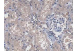 DAB staining on IHC-P; Samples: Human Kidney Tissue (CBY1/PGEA1 Antikörper  (AA 12-115))