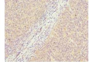 Immunohistochemistry of paraffin-embedded human tonsil tissue using ABIN7162885 at dilution of 1:100 (PCM1 Antikörper  (AA 1-260))