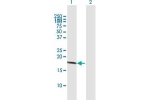 Western Blot analysis of IL10 expression in transfected 293T cell line by IL10 MaxPab polyclonal antibody. (IL-10 Antikörper  (AA 1-178))