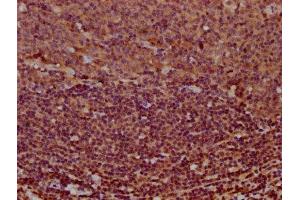 IHC image of ABIN7155184 diluted at 1:400 and staining in paraffin-embedded human tonsil tissue performed on a Leica BondTM system.