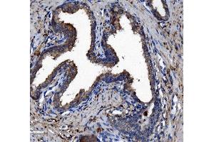 IHC analysis of Liver Carboxylesterase 1/CES1 using anti-Liver Carboxylesterase 1/CES1 antibody (ABIN7602719). (CES1 Antikörper  (AA 99-206))