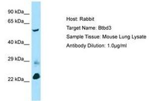 Image no. 1 for anti-BTB (POZ) Domain Containing 3 (BTBD3) (AA 367-416) antibody (ABIN6749832) (BTBD3 Antikörper  (AA 367-416))