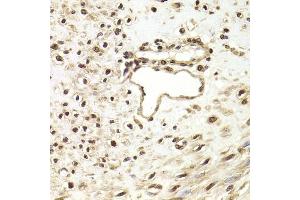 Immunohistochemistry of paraffin-embedded human leiomyoma of uterus using FKBP4 Antibody (ABIN5973289) at dilution of 1/200 (40x lens). (FKBP4 Antikörper)