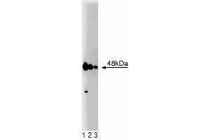 Western blot analysis of Caspase-2 on Jurkat cell lysate. (Caspase 2 Antikörper  (AA 225-401))
