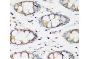 Immunohistochemistry of paraffin-embedded Human colon using BMP2 Polyclonal Antibody at dilution of 1:200 (40x lens). (BMP2 Antikörper)
