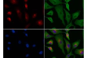 ABIN6264533 and ABIN6276573 staining HUVEC cells by IF/ICC. (PYCARD Antikörper  (N-Term))