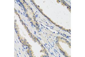 Immunohistochemistry of paraffin-embedded human prostate using RAD51C antibody (ABIN5974185) at dilution of 1/100 (40x lens). (RAD51C Antikörper)
