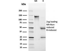 SDS-PAGE Analysis Purified HLA-Pan Mouse Monoclonal Antibody (CR3/43). (MHC Class II HLA-DP/DQ/DR Antikörper)