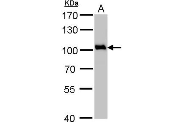 VCP 抗体  (N-Term)