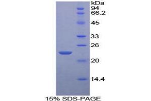 SDS-PAGE analysis of Mouse Iga Protein. (CD79a Protein)
