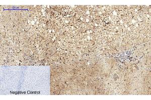 Immunohistochemical analysis of paraffin-embedded human liver tissue. (Caveolin-1 Antikörper  (AA 100-180))