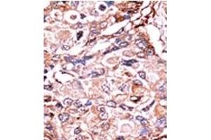Image no. 2 for anti-SMAD, Mothers Against DPP Homolog 3 (SMAD3) (pSer213) antibody (ABIN358226)