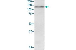 USP11 polyclonal antibody  staining (1 ug/mL) of Jurkat lysate (RIPA buffer, 30 ug total protein per lane).