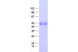 Western Blotting (WB) image for Tripartite Motif Containing 54 (TRIM54) protein (His tag) (ABIN2734286)