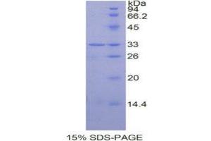 SDS-PAGE (SDS) image for Signal Transducer and Activator of Transcription 6, Interleukin-4 Induced (STAT6) (AA 262-520) protein (His tag) (ABIN1877493)