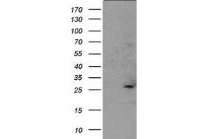 Western Blotting (WB) image for anti-Suppressor of Cytokine Signaling 3 (SOCS3) antibody (ABIN1501060)