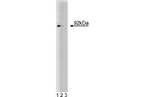 Western Blotting (WB) image for anti-Signal Transducer and Activator of Transcription 5A (STAT5A) (AA 451-649) antibody (ABIN967811)