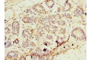 Immunohistochemistry of paraffin-embedded human breast cancer using ABIN7164746 at dilution of 1:100 (PA2G4 Antikörper  (AA 2-394))