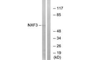 Western blot analysis of extracts from MCF-7 cells, using NXF3 Antibody. (NXF3 Antikörper  (AA 72-121))