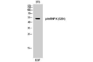 Western Blotting (WB) image for anti-Heterogeneous Nuclear Ribonucleoprotein K (HNRNPK) (pSer284) antibody (ABIN3182264) (HNRNPK Antikörper  (pSer284))