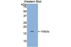 Western blot analysis of the recombinant protein. (TPSAB1 Antikörper  (AA 29-148))