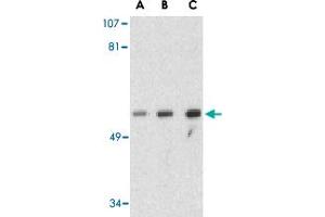 Western blot analysis of GOPC in PC-3 cell lysate with GOPC polyclonal antibody  at (A) 1, (B) 2 and (C) 4 ug/mL . (GOPC Antikörper  (Internal Region))