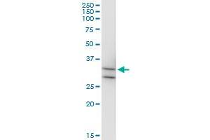 MPPED2 monoclonal antibody (M08), clone 4H5. (MPPED2 Antikörper  (AA 1-294))