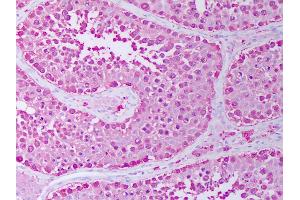 Anti-HSP90 / Heat Shock Protein 90 antibody IHC of human testis, seminiferous ducts.