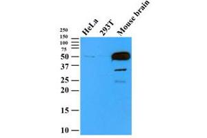 Western Blotting (WB) image for anti-Tubulin, beta 2B (TUBB2B) antibody (ABIN567611)