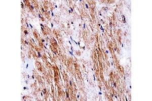 Ddr2 antibody immunohistochemistry analysis in formalin fixed and paraffin embedded mouse heart tissue. (DDR2 Antikörper  (AA 816-843))
