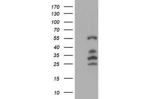 Western Blotting (WB) image for anti-Interferon Regulatory Factor 6 (IRF6) antibody (ABIN1498901) (IRF6 Antikörper)