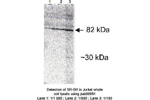 Image no. 1 for anti-Scavenger Receptor Class B, Member 2 (SCARB2) antibody (ABIN363400) (SCARB2 Antikörper)