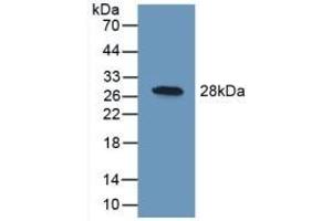UCHL1 抗体  (AA 2-223)