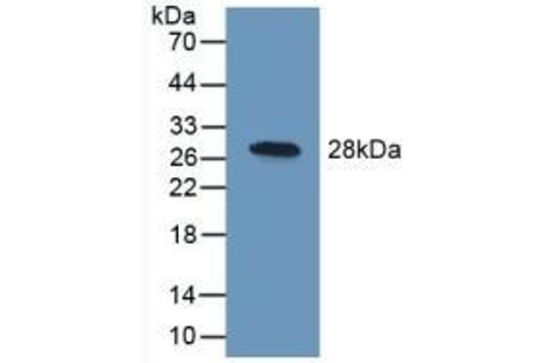 UCHL1 抗体  (AA 2-223)